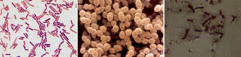 Escherichia coli, les entérocoques fécaux et Proteus sont les principaux agents responsables de la prostatite bactérienne chronique