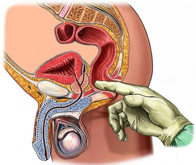 Examen numérique de la prostate