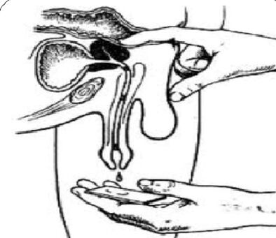 Massage de la prostate pour avoir un secret