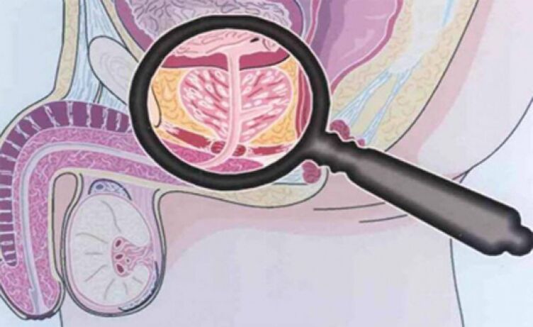 Prostate et sa localisation